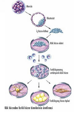 Kök Hücre Tedavisi