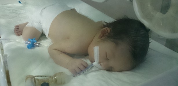 5 günlük bebek yaşam mücadelesi veriyor 
