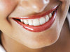 Dişlerde kalıcı beyazlık mümkün 