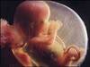Kürtaj olanlar çocuk sahibi olamayabilir! / VİDEO 
