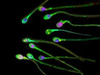 Sperm kalitesini etkileyen boya maddesi 