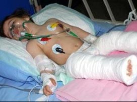 Zeynep bebeğin sağlığı son derece iyi