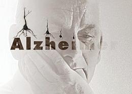 Alzheimer hastasi olmamak icin... 