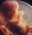 6 aylık hamile liseliye kürtaj yapılmış