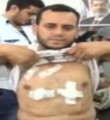 Yaralılar Mısır'daki katliam anını anlattı