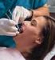 Çarpık dişlere telsiz tedavi