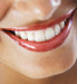 Dişlerde kalıcı beyazlık mümkün