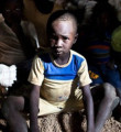Güney Sudanlı çocuklar uyku hastalığının pençesinde
