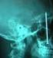 Şoke eden röntgen filmleri / GALERİ