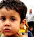 Suriyelilerden yayılan bu hastalık Türkiye'yi sarıyor
